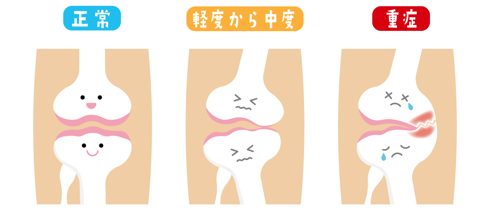 膝関節の役割